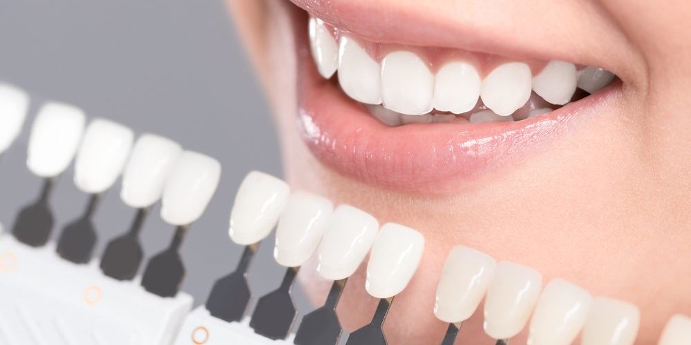 A Quick Look At Cosmetic Dentistry And Aspects That Matter!