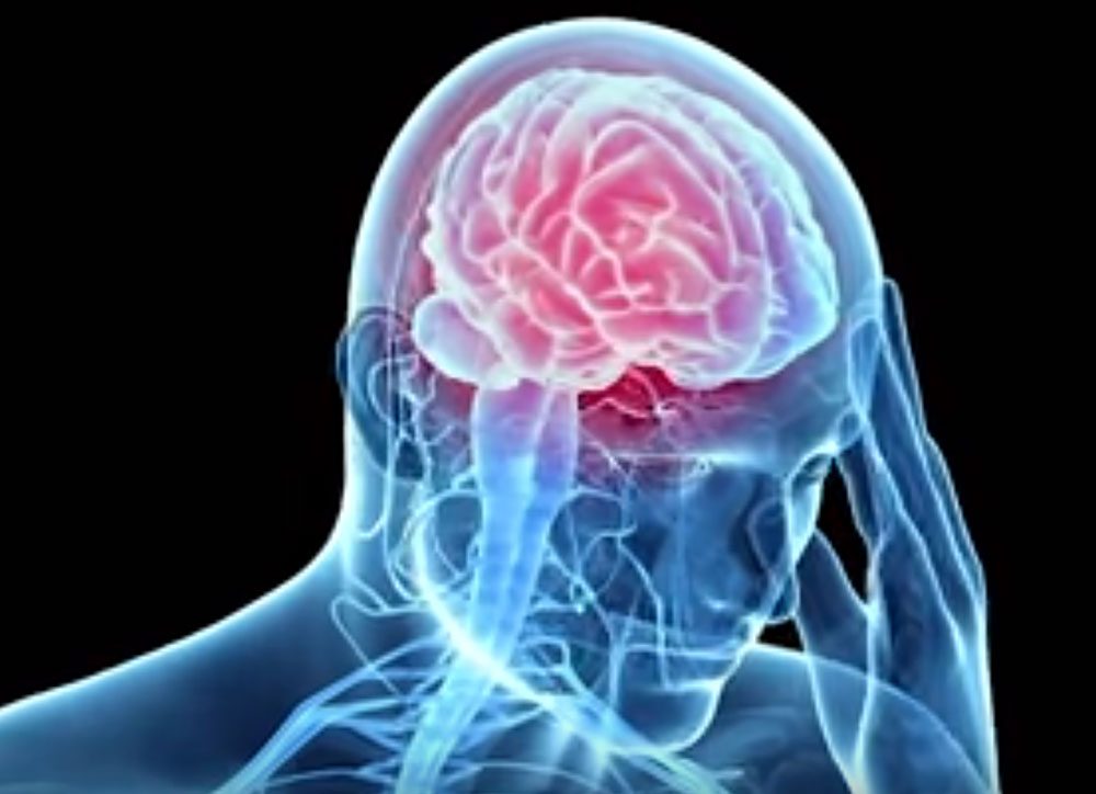 Traumatic Brain Injury Recovery